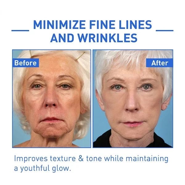 Elixiris™️ Antiage Anti Wrinkle Face Serum Solution