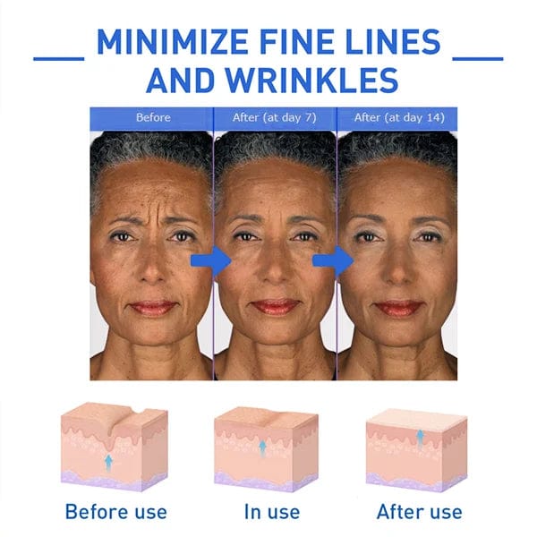 Face Serum Retinol Anti Ageing Serum Retinol For Skin - Elixiris™️ Elixiris™️ Solution Poshure®