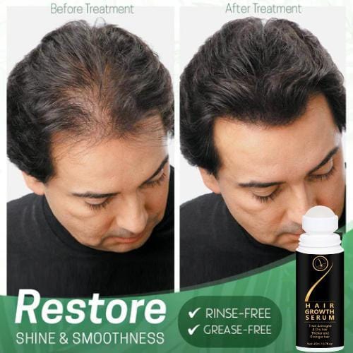 Hair Serum for Hair Growth Serum For Damaged & Dry Hair 45ml (Pack Of 2) Hair Serum for Hair Growth Serum For Damaged & Dry Hair 45ml Roposo Clout