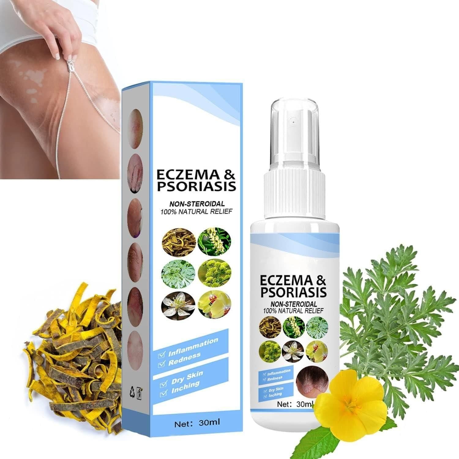 Herbal Psoriasis Relief Spray (Pack Of 2) Poshure®