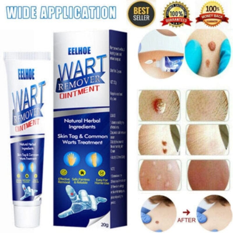 Wart Remover Ice Cream Mask Poshure®