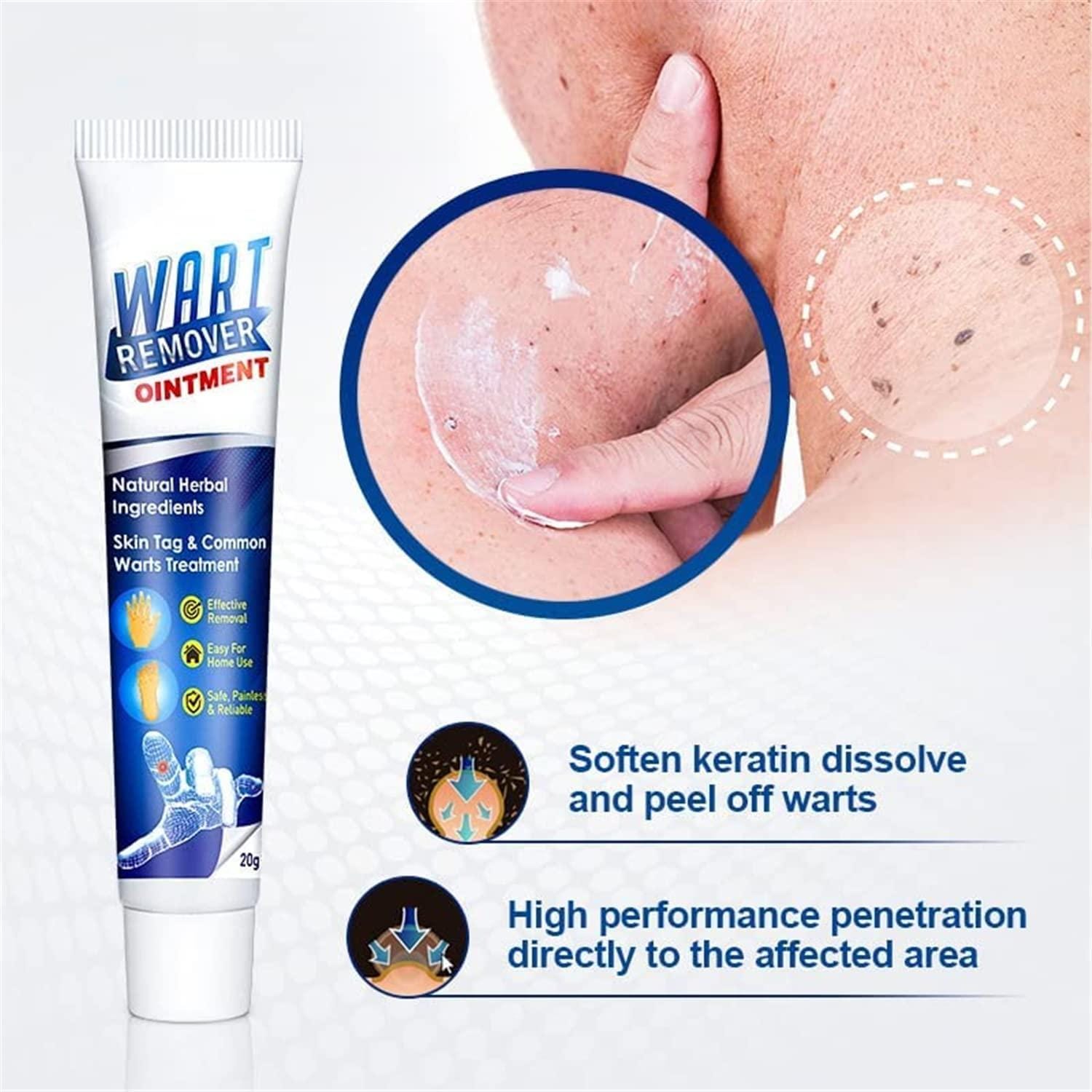 WartsOff Instant Blemish Removal Cream Warts Off Instant Blemish Removal Cream 20 g Wart Remover Ointment for All Skin Types (Pack of 1) Poshure®